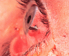 Click image for larger version

Name:	eye-injury.gif‎
Views:	891
Size:	77,4 Kt
ID:	58701